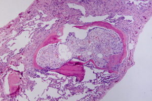 Dr. Kristin Foley publishes article on abnormal bone growth